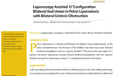Laparoscopy assisted 'U' configuration bilateral ileal ureter in pelvic lipomatosis with bilateral ureteric obstruction.