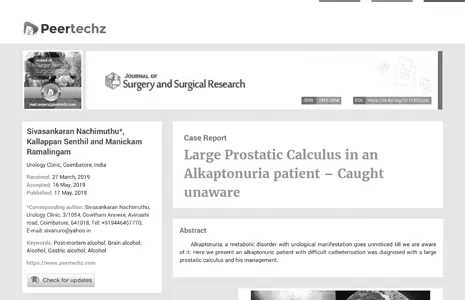 Large Prostatic Calculus in an Alkaptonuria patient – Caught unaware